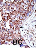 PAB1938 - RCE1