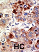 PAB1939 - Androgen receptor