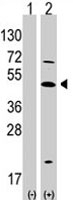 PAB1948 - ATOH1