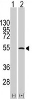 PAB1950 - ERVWE1