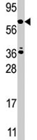 PAB1962 - RELA / NF-kB p65