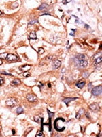 PAB1962 - RELA / NF-kB p65