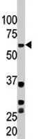 PAB1964 - SMAD3