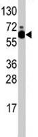 PAB1967 - RPS6KB1 / STK14A