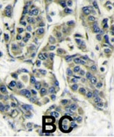 PAB1967 - RPS6KB1 / STK14A