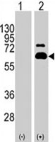 PAB1968 - RPS6KB1 / STK14A