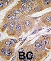 PAB1971 - RPS6KB1 / STK14A