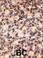 PAB1978 - Jagged-2 / JAG2