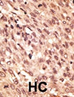 PAB1979 - LRP5