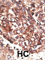 PAB1983 - MMP-13