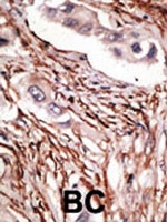 PAB1984 - NOTCH3
