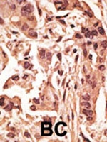 PAB1985 - SIRT6