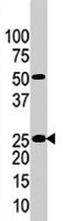 PAB1994 - KLK4 / Kallikrein-4