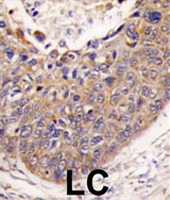 PAB2010 - Frataxin (FXN)