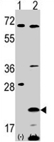 PAB2010 - Frataxin (FXN)