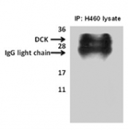 PAB2020 - Deoxycytidine kinase