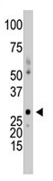 PAB2020 - Deoxycytidine kinase