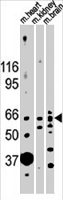 PAB2022 - Activin receptor type 2B / ACVR2B