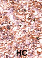 PAB2022 - Activin receptor type 2B / ACVR2B