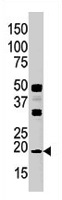 PAB2028 - NME3