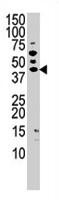PAB2029 - PANK3