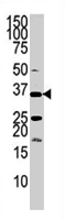 PAB2030 - PANK3