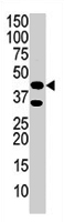 PAB2036 - Phosphoglycerate kinase 1 (PGK1)