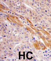 PAB2036 - Phosphoglycerate kinase 1 (PGK1)