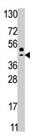 PAB2041 - SEPHS2