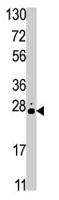 PAB2043 - STK19