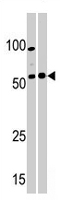PAB2045 - PKMYT1