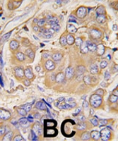 PAB2047 - HSPB1 / HSP27