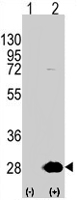 PAB2047 - HSPB1 / HSP27