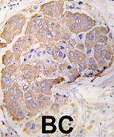PAB2048 - HSPB1 / HSP27