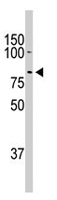 PAB2050 - Doublecortin-like kinase 1