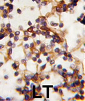 PAB2053 - RICTOR