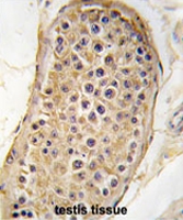 PAB2054 - RICTOR