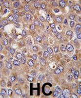 PAB2057 - Insulin