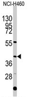 PAB2058 - engrailed-1 / EN1