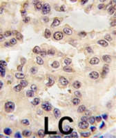 PAB2058 - engrailed-1 / EN1
