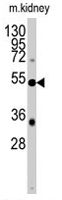 PAB2059 - engrailed-1 / EN1