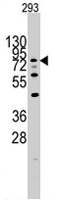 PAB2067 - DYRK1A
