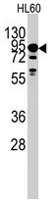 PAB2068 - DYRK1A