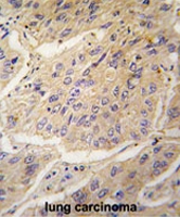 PAB2069 - Caspase-3