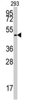 PAB2072 - E2F1