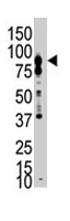 PAB2074 - EPHB6
