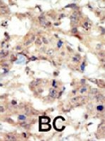 PAB2074 - EPHB6