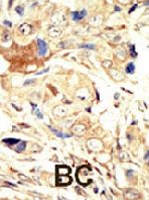 PAB2075 - EGFR / ERBB1