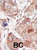 PAB2089 - CD309 / VEGFR-2 / Flk-1