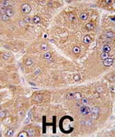 PAB2090 - Alpha-L-fucosidase 2 / FUCA2